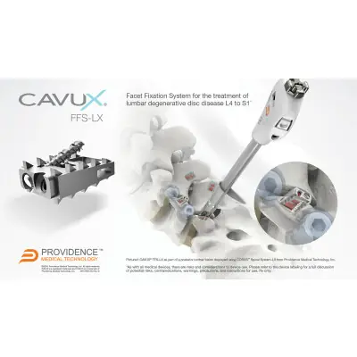 Envío Gratis Juego de fuelles, árbol de transmisión CAUTEX/FACET 81311 CAUTEX/FACET 081311